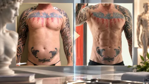 Houston surgeon combines sculpture and science in modern body contouring